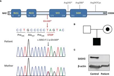 Case Report: X-Linked SASH3 Deficiency Presenting as a Common Variable Immunodeficiency